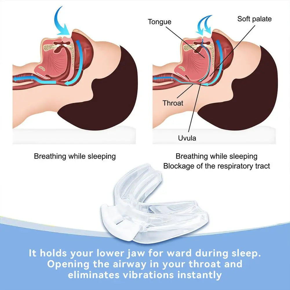 QuiteNite™️ Anti-snoring Mouthpiece